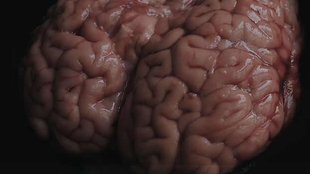 Brain Site.jpg